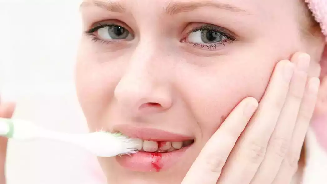 Chảy máu chân răng gây nguy hiểm đến sức khỏe