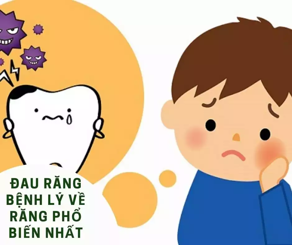 Đau răng  là một bệnh lý về răng phổ biến nhất
