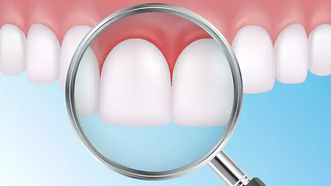 những triệu chứng khi mọc răng khôn