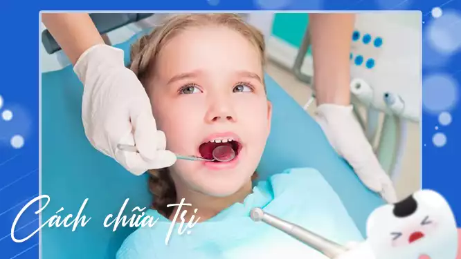 Cách chữa trị sâu răng ở trẻ nhỏ